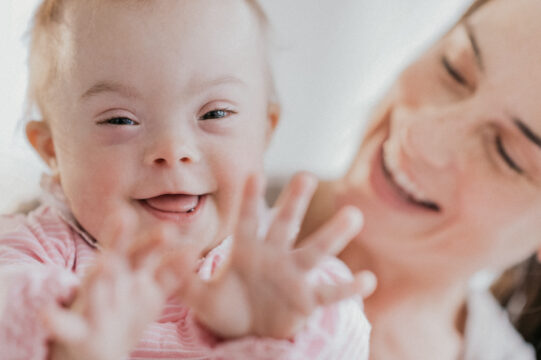 mother with happy baby with Down syndrome