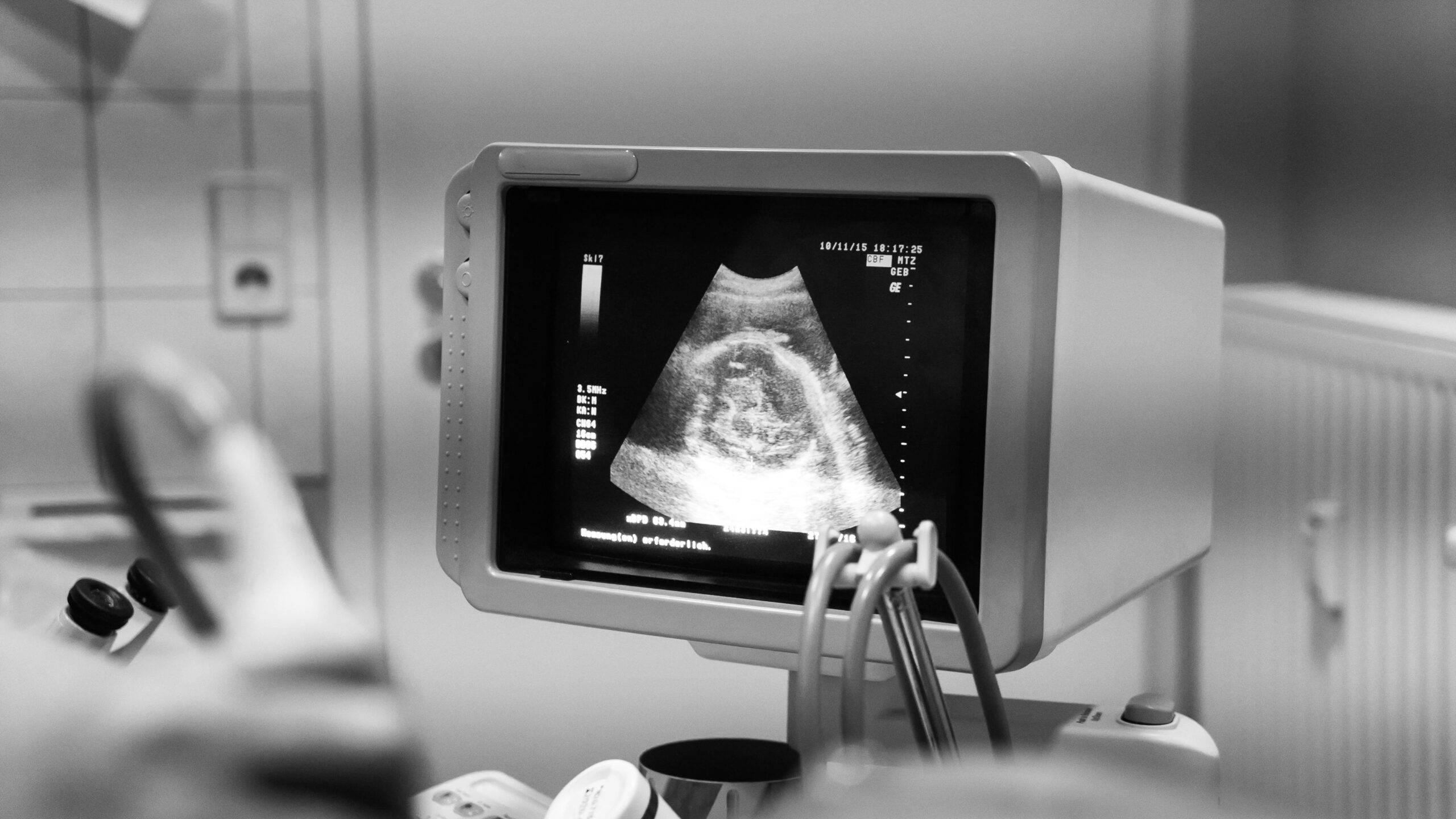 Screen showing baby in ultrasound machine