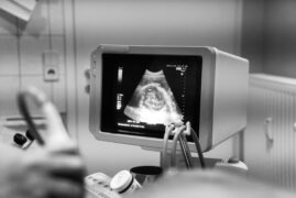Screen showing baby in ultrasound machine