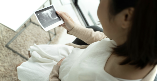 Pregnant woman looking at her ultrasound image