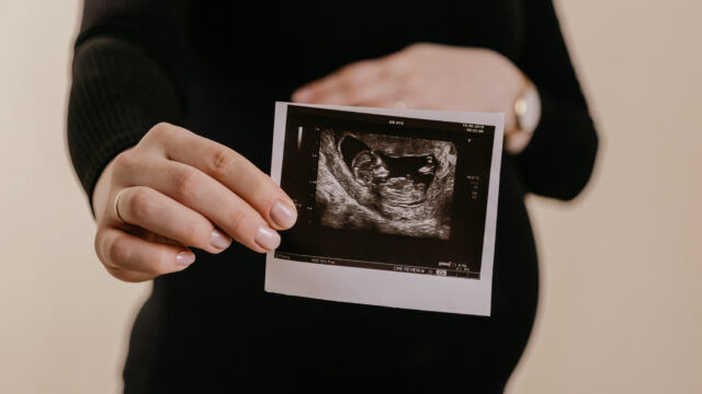 woman holding ultrasound