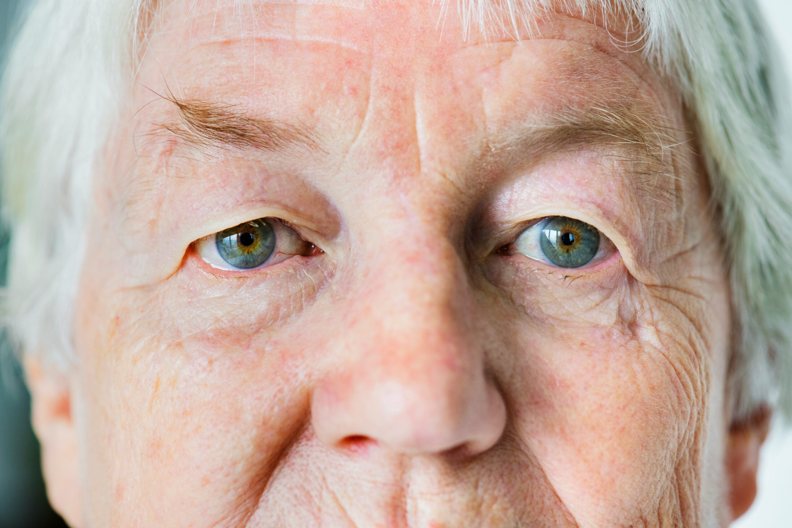 elderly person's eyes close up