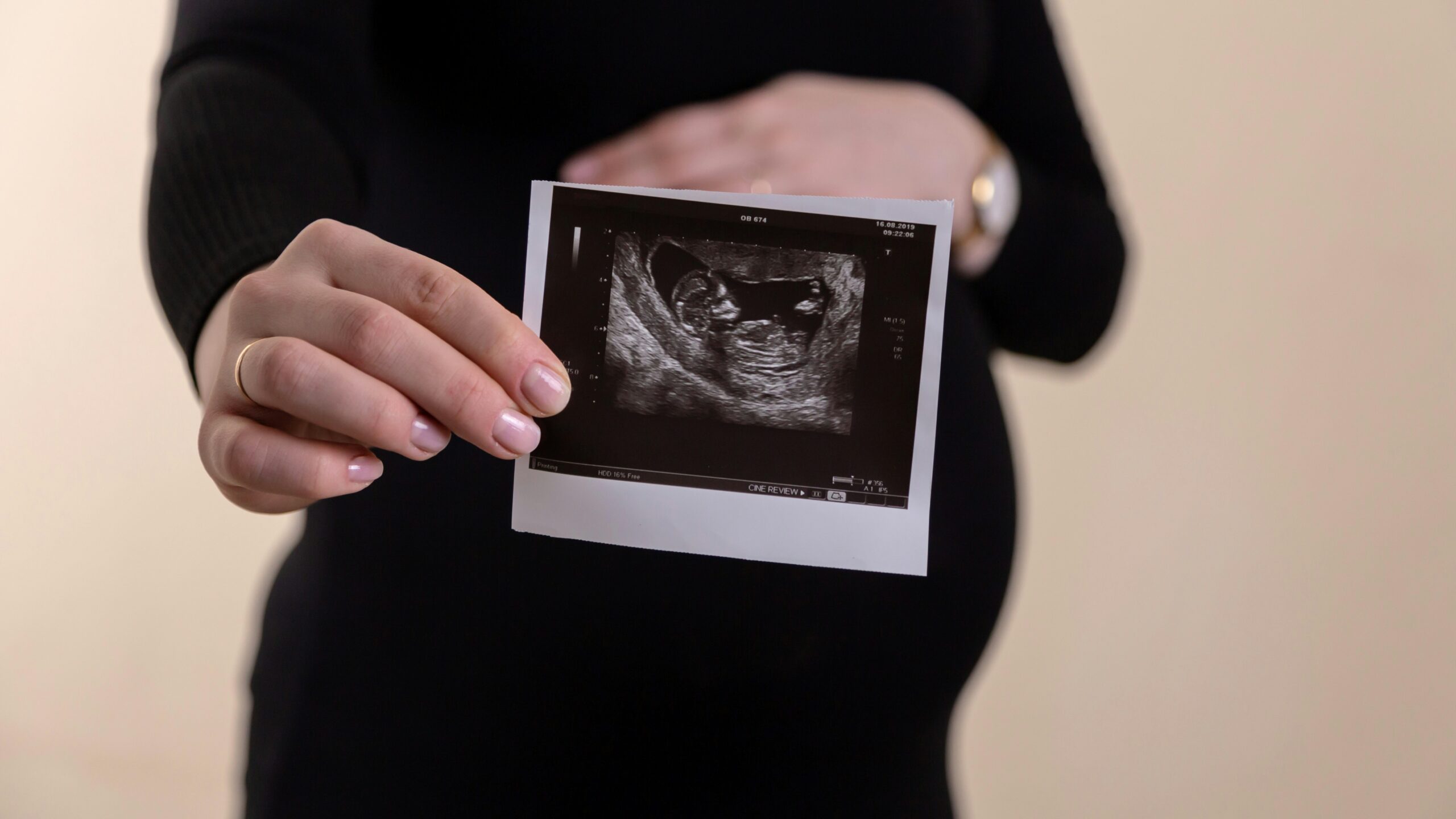 woman holding a sonogram print