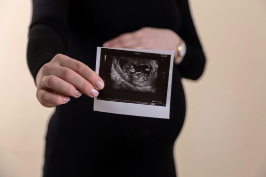 woman holding a sonogram print