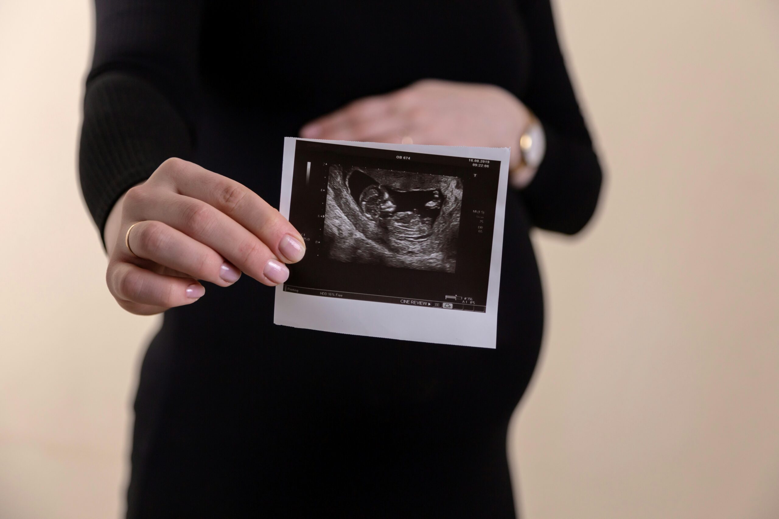 woman holding a sonogram print