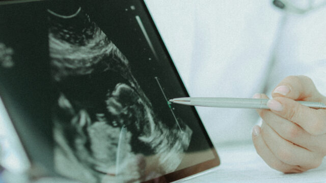 Doctor demonstrates fetal ultrasound on tablet screen
