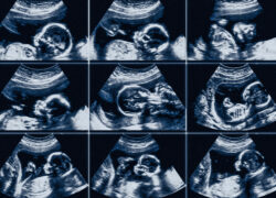 recommended article photo